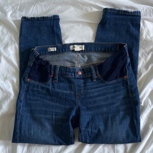 Madewell Dark Blue Skinny Jeans